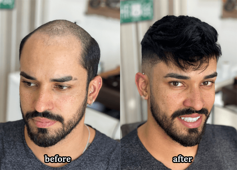 DIYSTAR™Root Activator Shampoo