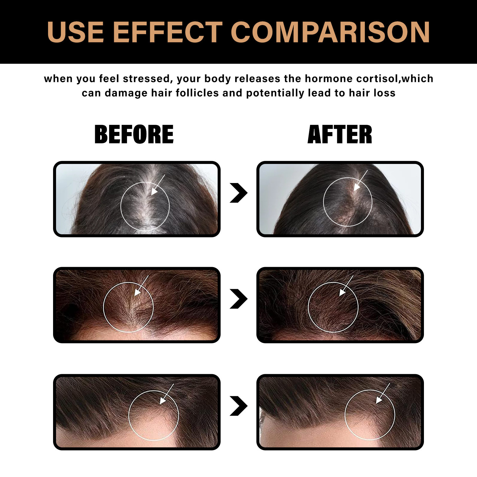 DIYSTAR™Root Activator Shampoo