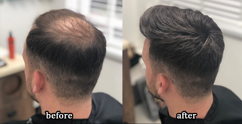 DIYSTAR™Root Activator Shampoo