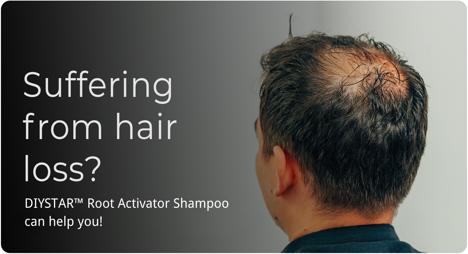 DIYSTAR™Root Activator Shampoo