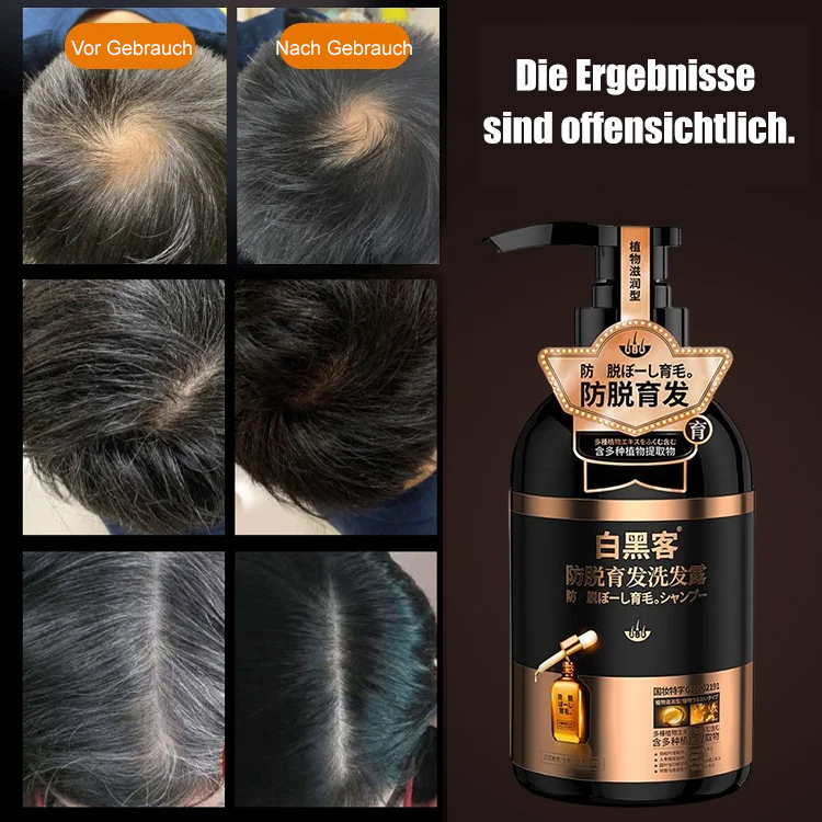White Hacker Anti-Haarausfall Shampoo