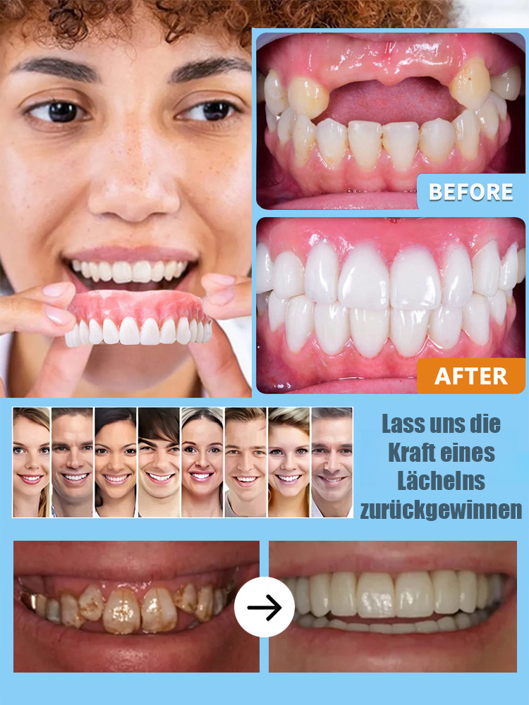 DIY-Anpassung – ohne Kleber, Zahnarzt oder Termin!【200.000 Rückkäufe】Zahnkosmetik-Set