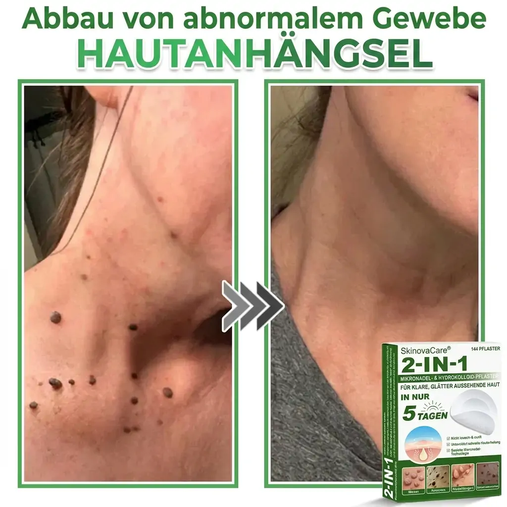 【𝐎𝐟𝐟𝐢𝐳𝐢𝐞𝐥𝐥𝐞𝐫 𝐅𝐥𝐚𝐠𝐬𝐡𝐢𝐩-𝐒𝐭𝐨𝐫𝐞】⏰Letzter Tag der Aktion: 60 % RABATT