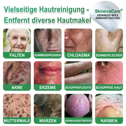 【𝐎𝐟𝐟𝐢𝐳𝐢𝐞𝐥𝐥𝐞𝐫 𝐅𝐥𝐚𝐠𝐬𝐡𝐢𝐩-𝐒𝐭𝐨𝐫𝐞】⏰Letzter Tag der Aktion: 60 % RABATT