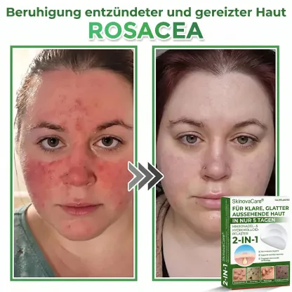 【𝐎𝐟𝐟𝐢𝐳𝐢𝐞𝐥𝐥𝐞𝐫 𝐅𝐥𝐚𝐠𝐬𝐡𝐢𝐩-𝐒𝐭𝐨𝐫𝐞】⏰Letzter Tag der Aktion: 60 % RABATT