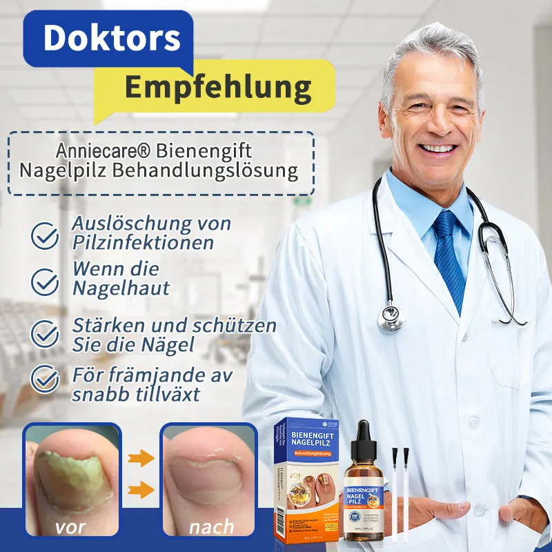 Anniecare® Bienengift Nagelpilz Behandlungslösung: Das Nagelpilzproblem vollständig lösen🌟