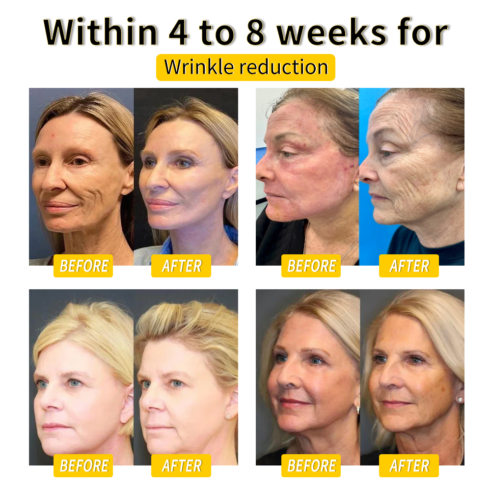 𝑨𝒏𝒏𝒊𝒆𝑪𝒂𝒓𝒆® 𝑩𝒊𝒆𝒏𝒆𝒏𝒈𝒊𝒇𝒕 𝑳𝒚𝒎𝒑𝒉𝒅𝒓𝒂𝒊𝒏𝒂𝒈𝒆 & 𝑯𝒂𝒖𝒕𝒔𝒕𝒓𝒂𝒇𝒇𝒆𝒏𝒅𝒆 𝑺𝒍𝒊𝒎𝒎𝒊𝒏𝒈-𝑪𝒓𝒆𝒎𝒆 🐝