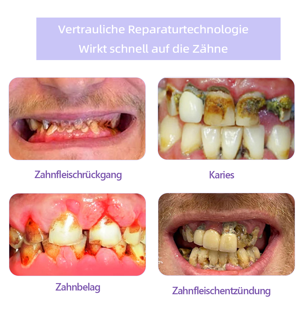 𝐀𝐧𝐧𝐢𝐞𝐂𝐚𝐫𝐞® 𝐙𝐚𝐡𝐧𝐫𝐞𝐩𝐚𝐫𝐚𝐭𝐮𝐫-𝐌𝐢𝐧𝐞𝐫𝐚𝐥𝐩𝐮𝐝𝐞𝐫👩⚕️(𝐄𝐦𝐩𝐟𝐨𝐡𝐥𝐞𝐧 𝐯𝐨𝐧 𝐝𝐞𝐫 𝐃𝐆𝐙𝐌𝐊)Letzter Tag Rabatt🔥