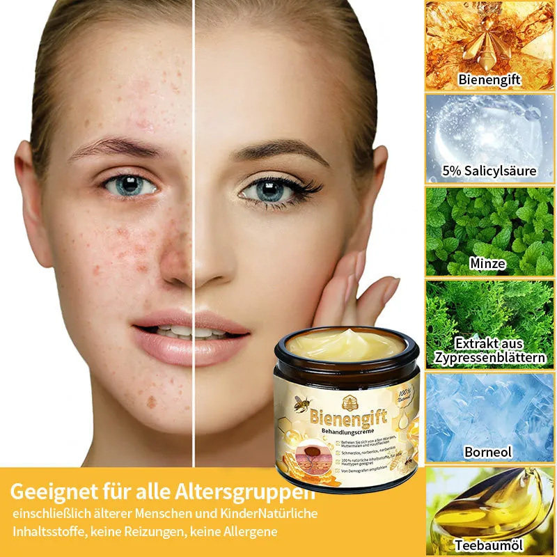 Herbst-Hautpflege AnnieCare Bienengift-Hautpflegecreme (AAD Empfohlen) (Letzte Tag Promotion, 80% Rabatt)