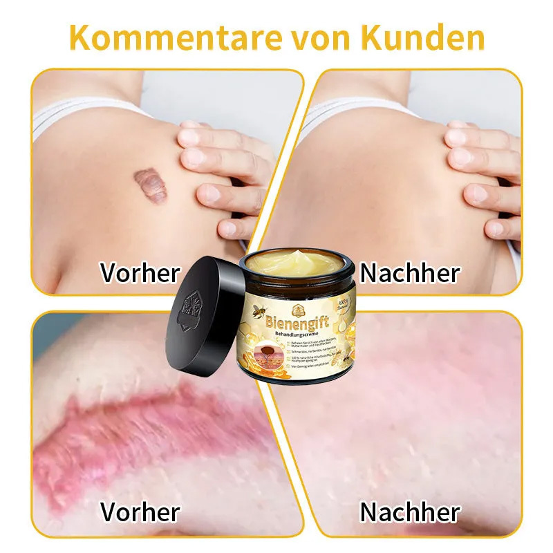 Herbst-Hautpflege AnnieCare Bienengift-Hautpflegecreme (AAD Empfohlen) (Letzte Tag Promotion, 80% Rabatt)