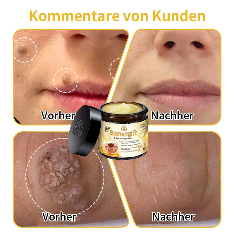 Herbst-Hautpflege AnnieCare Bienengift-Hautpflegecreme (AAD Empfohlen) (Letzte Tag Promotion, 80% Rabatt)