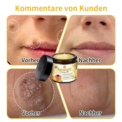 Herbst-Hautpflege AnnieCare Bienengift-Hautpflegecreme (AAD Empfohlen) (Letzte Tag Promotion, 80% Rabatt)