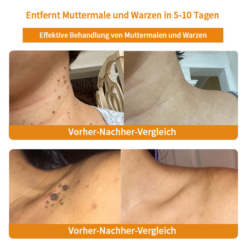 Herbst-Hautpflege Turonu Bienengift-Hautpflegecreme (AAD Empfohlen) (Letzte Tag Promotion, 80% Rabatt)