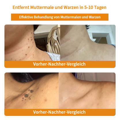 Herbst-Hautpflege Turonu Bienengift-Hautpflegecreme (AAD Empfohlen) (Letzte Tag Promotion, 80% Rabatt)