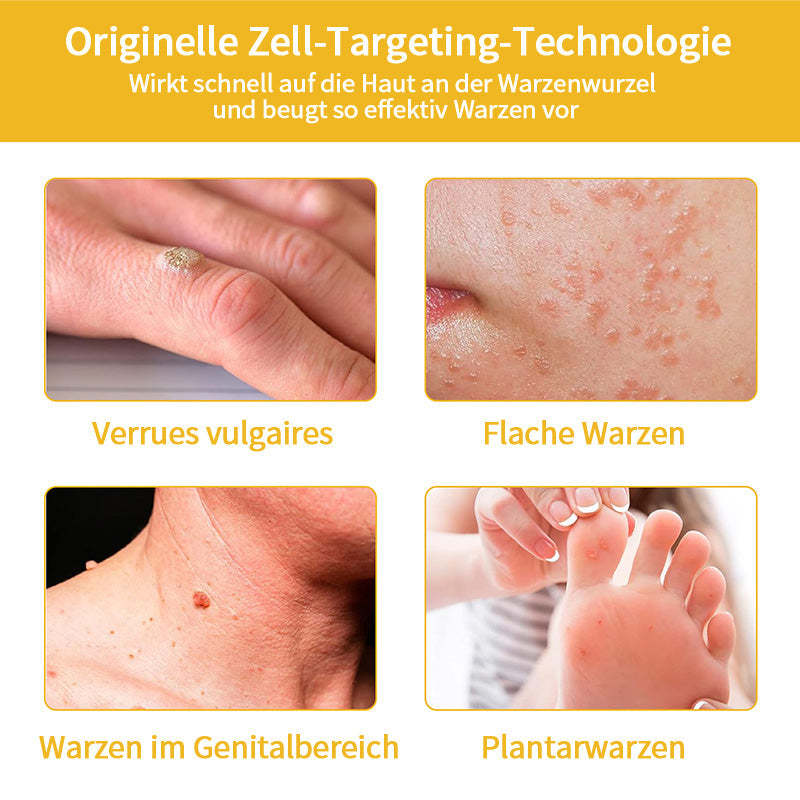 Herbst-Hautpflege Turonu Bienengift-Hautpflegecreme (AAD Empfohlen) (Letzte Tag Promotion, 80% Rabatt)
