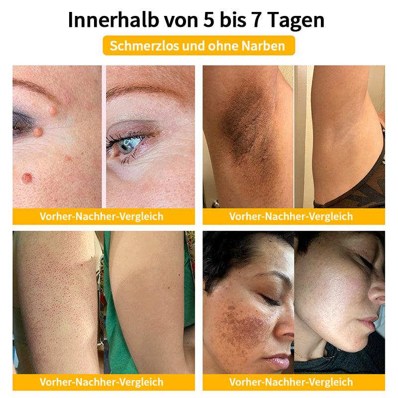 Herbst-Hautpflege Turonu Bienengift-Hautpflegecreme (AAD Empfohlen) (Letzte Tag Promotion, 80% Rabatt)
