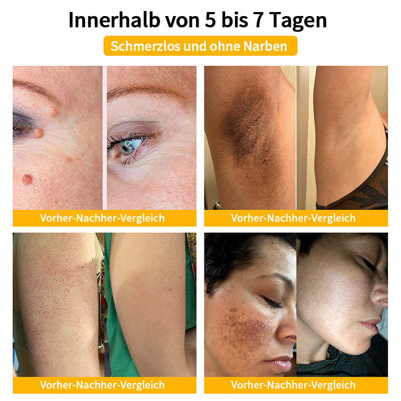 Herbst-Hautpflege Turonu Bienengift-Hautpflegecreme (AAD Empfohlen) (Letzte Tag Promotion, 80% Rabatt)