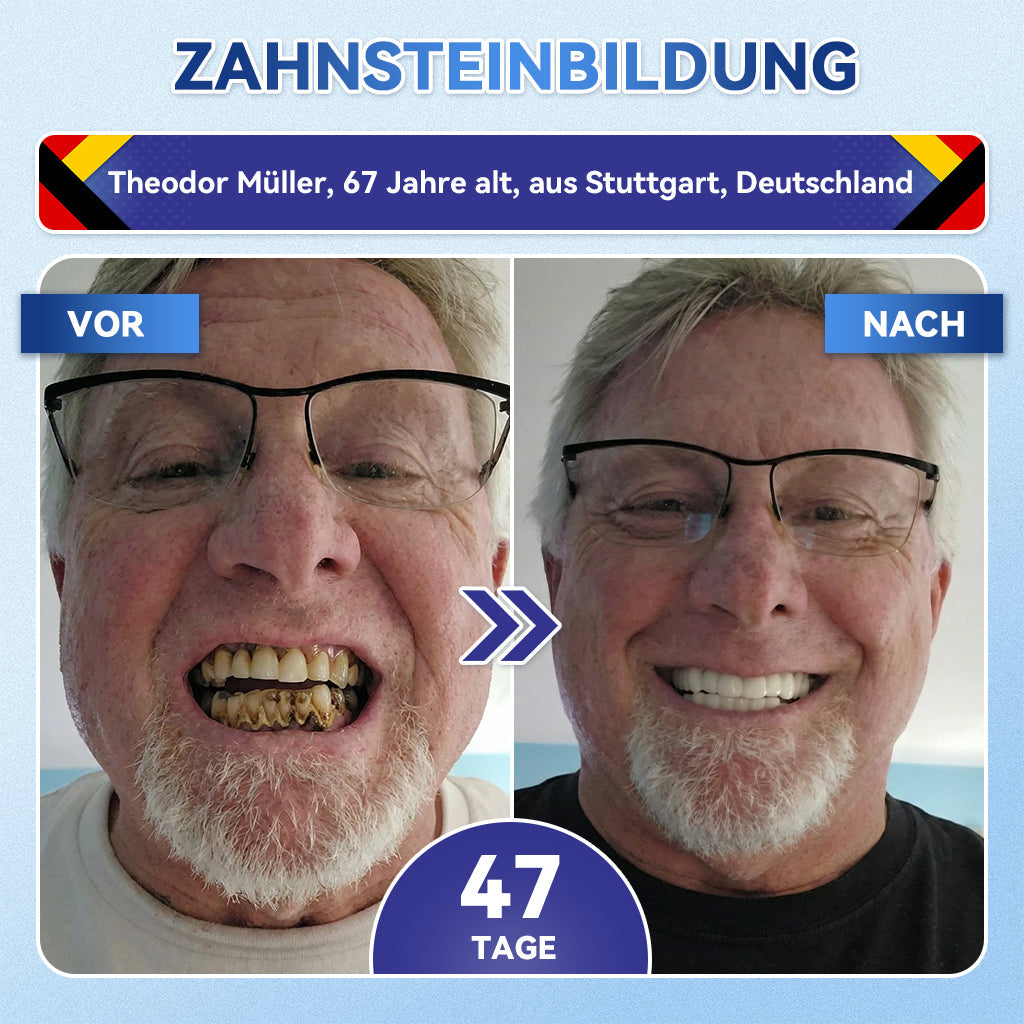 𝐺𝑙𝑖𝑚𝑚𝑒𝑟𝑙𝑦®🌳 Tideglusib Zahn & Zahnfleisch Schnelllösliche Repair-Mundstreifen