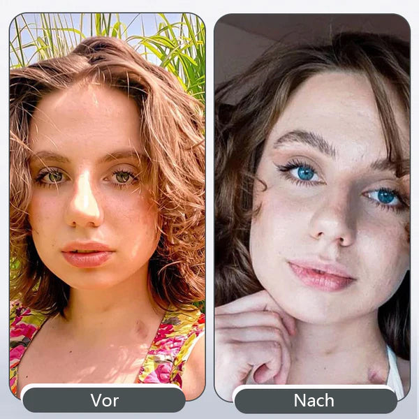 AnnieCare® Augentropfen zur Verbesserung und Veränderung der Augenfarbe