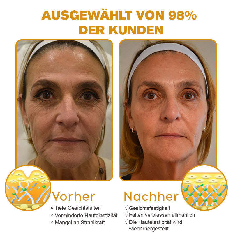 👨‍⚕️ Hergestellt in Deutschland - ✨Pureluxo® Botox Bienenvenom Faltenentfernungscreme