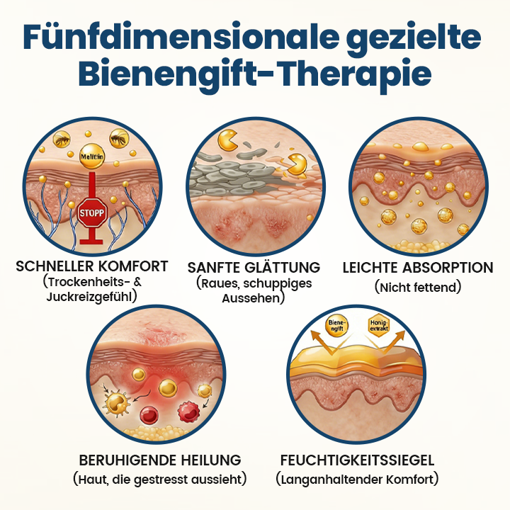 Timilk® BeeVenom Psoriasis-Behandlungscreme