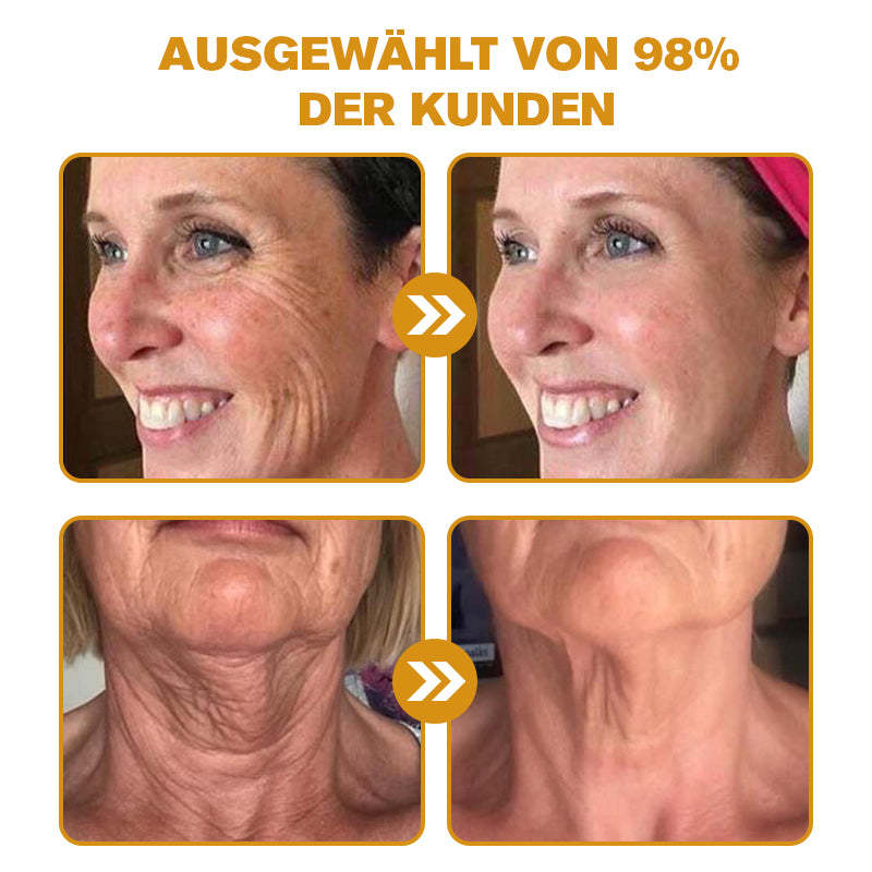 👨‍⚕️ Hergestellt in Deutschland - ✨Pureluxo® Botox Bienenvenom Faltenentfernungscreme