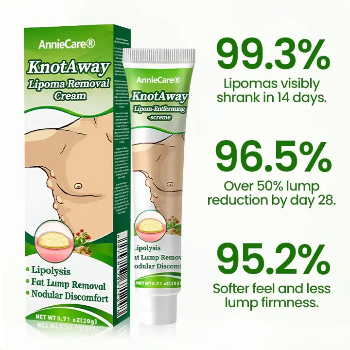⏰Last Day Promotion: 60% OFF🔥 Cvreoz® KnotAway Lipoma Removal Cream