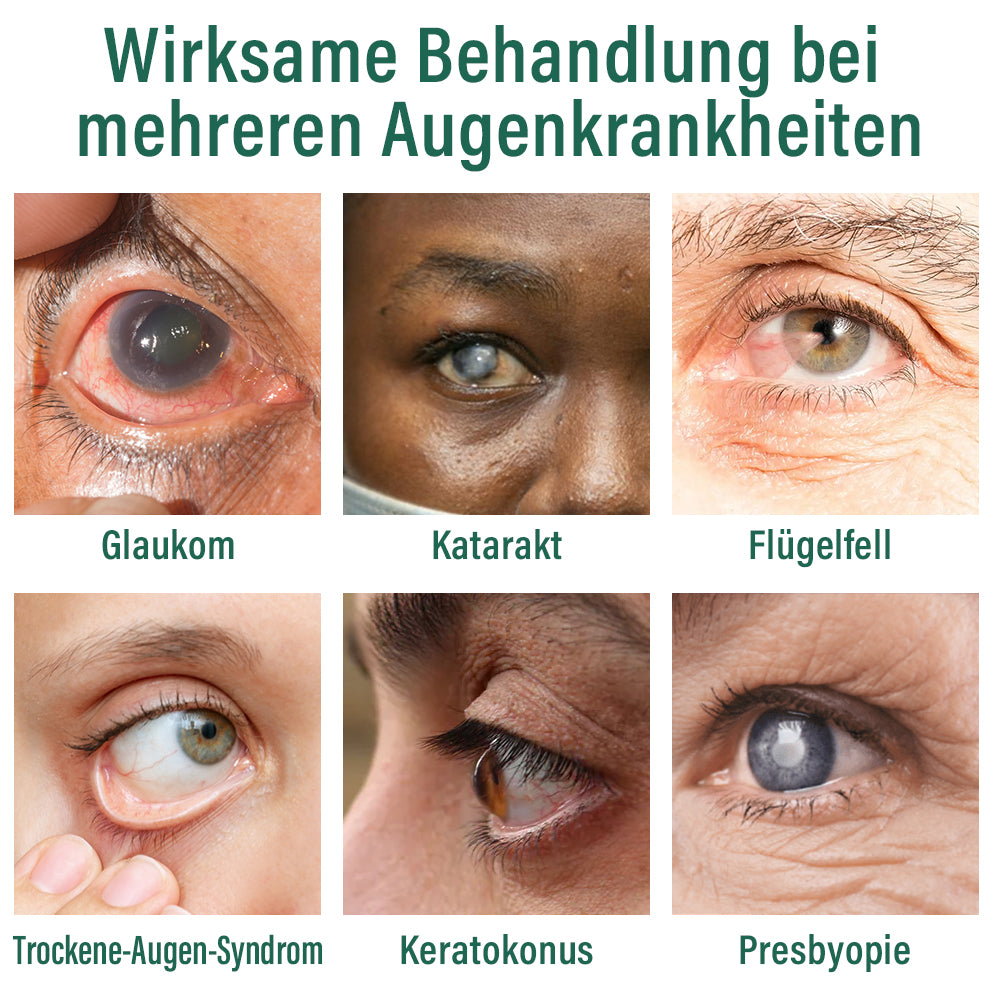 ✅Ourlyard® Nano Augentropfen Serum 👩‍⚕️Geeignet für Presbyopie, trockene Augen, Glaukom und Katarakte
