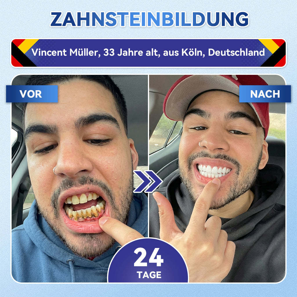 𝐺𝑙𝑖𝑚𝑚𝑒𝑟𝑙𝑦®🌳 Tideglusib Zahn & Zahnfleisch Schnelllösliche Repair-Mundstreifen