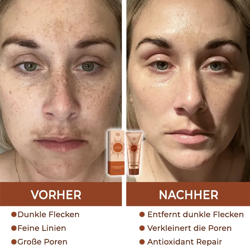 【𝐎𝐟𝐟𝐢𝐳𝐢𝐞𝐥𝐥𝐞𝐫 𝐅𝐥𝐚𝐠𝐬𝐡𝐢𝐩-𝐒𝐭𝐨𝐫𝐞】⏰Letzter Tag der Aktion: 60 % RABATT - 𝐀𝐧𝐧𝐢𝐞𝐂𝐚𝐫𝐞® 𝐇𝐞𝐫𝐛𝐚𝐥 𝐒𝐩𝐨𝐭𝐬 𝐏𝐞𝐞𝐥-𝐎𝐟𝐟-𝐆𝐞𝐬𝐢𝐜𝐡𝐭𝐬𝐦𝐚𝐬𝐤𝐞