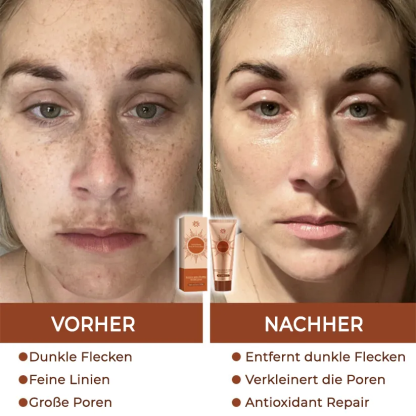 【𝐎𝐟𝐟𝐢𝐳𝐢𝐞𝐥𝐥𝐞𝐫 𝐅𝐥𝐚𝐠𝐬𝐡𝐢𝐩-𝐒𝐭𝐨𝐫𝐞】⏰Letzter Tag der Aktion: 60 % RABATT - 𝐀𝐧𝐧𝐢𝐞𝐂𝐚𝐫𝐞® 𝐇𝐞𝐫𝐛𝐚𝐥 𝐒𝐩𝐨𝐭𝐬 𝐏𝐞𝐞𝐥-𝐎𝐟𝐟-𝐆𝐞𝐬𝐢𝐜𝐡𝐭𝐬𝐦𝐚𝐬𝐤𝐞