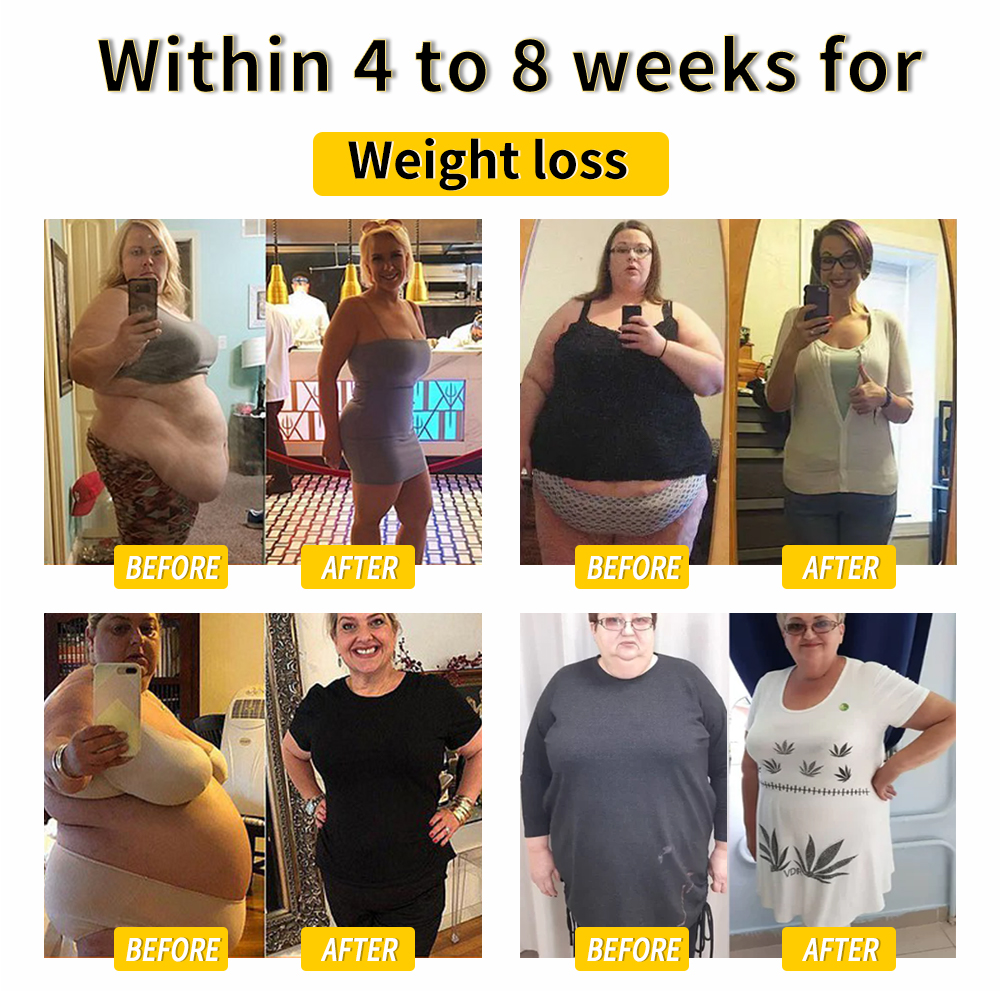 𝑨𝒏𝒏𝒊𝒆𝑪𝒂𝒓𝒆® 𝑩𝒊𝒆𝒏𝒆𝒏𝒈𝒊𝒇𝒕 𝑳𝒚𝒎𝒑𝒉𝒅𝒓𝒂𝒊𝒏𝒂𝒈𝒆 & 𝑯𝒂𝒖𝒕𝒔𝒕𝒓𝒂𝒇𝒇𝒆𝒏𝒅𝒆 𝑺𝒍𝒊𝒎𝒎𝒊𝒏𝒈-𝑪𝒓𝒆𝒎𝒆 🐝