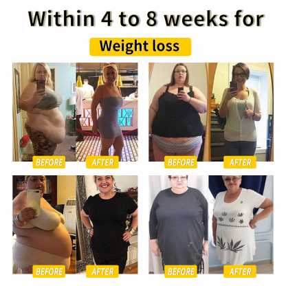 𝑨𝒏𝒏𝒊𝒆𝑪𝒂𝒓𝒆® 𝑩𝒊𝒆𝒏𝒆𝒏𝒈𝒊𝒇𝒕 𝑳𝒚𝒎𝒑𝒉𝒅𝒓𝒂𝒊𝒏𝒂𝒈𝒆 & 𝑯𝒂𝒖𝒕𝒔𝒕𝒓𝒂𝒇𝒇𝒆𝒏𝒅𝒆 𝑺𝒍𝒊𝒎𝒎𝒊𝒏𝒈-𝑪𝒓𝒆𝒎𝒆 🐝