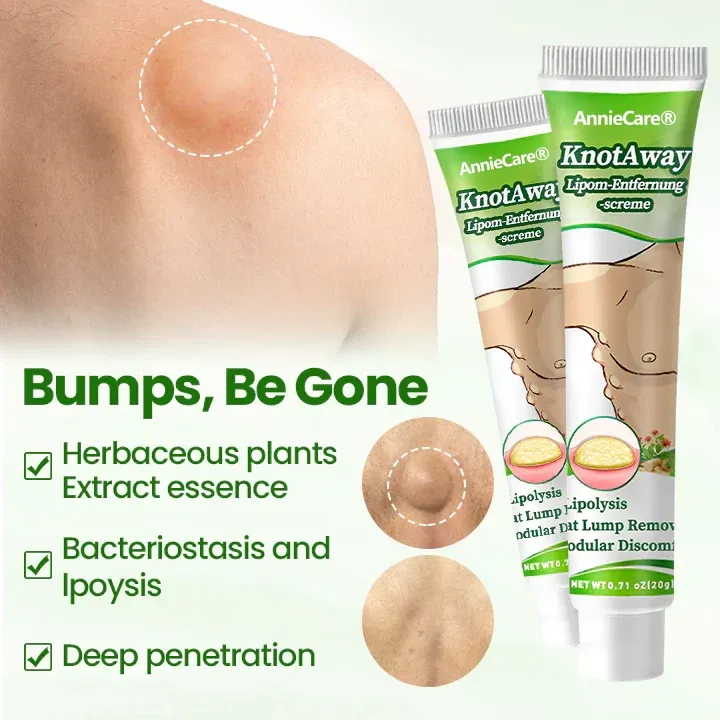 ⏰Last Day Promotion: 60% OFF🔥 Cvreoz® KnotAway Lipoma Removal Cream