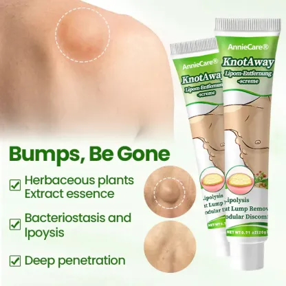 ⏰Last Day Promotion: 60% OFF🔥 Cvreoz® KnotAway Lipoma Removal Cream