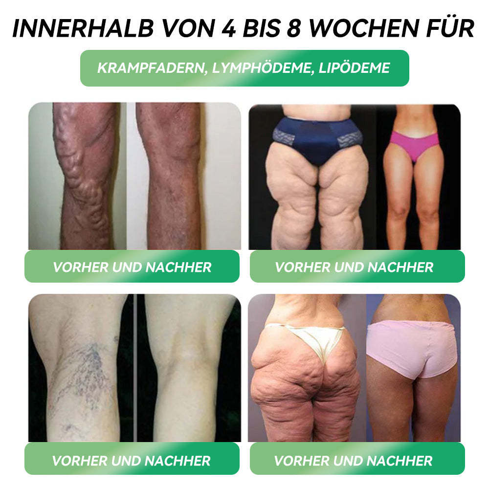 ⏰𝐋𝐞𝐭𝐳𝐭𝐞𝐫 𝐓𝐚𝐠 𝐝𝐞𝐫 𝐀𝐤𝐭𝐢𝐨𝐧: 𝟔𝟎 % 𝐑𝐀𝐁𝐀𝐓𝐓🇩🇪𝐏𝐞𝐚𝐤𝐚® 𝐆𝐋𝐏-𝟏 𝐎𝐫𝐚𝐥𝐞 𝐋ö𝐬𝐮𝐧𝐠 🌸 Nur 1x pro Woche, erste Veränderungen in 7 Tagen sichtbar ✅ Für Adipositas, Herz-Kreislauf, Diabetes, Schlafapnoe, Gelenke und mehr