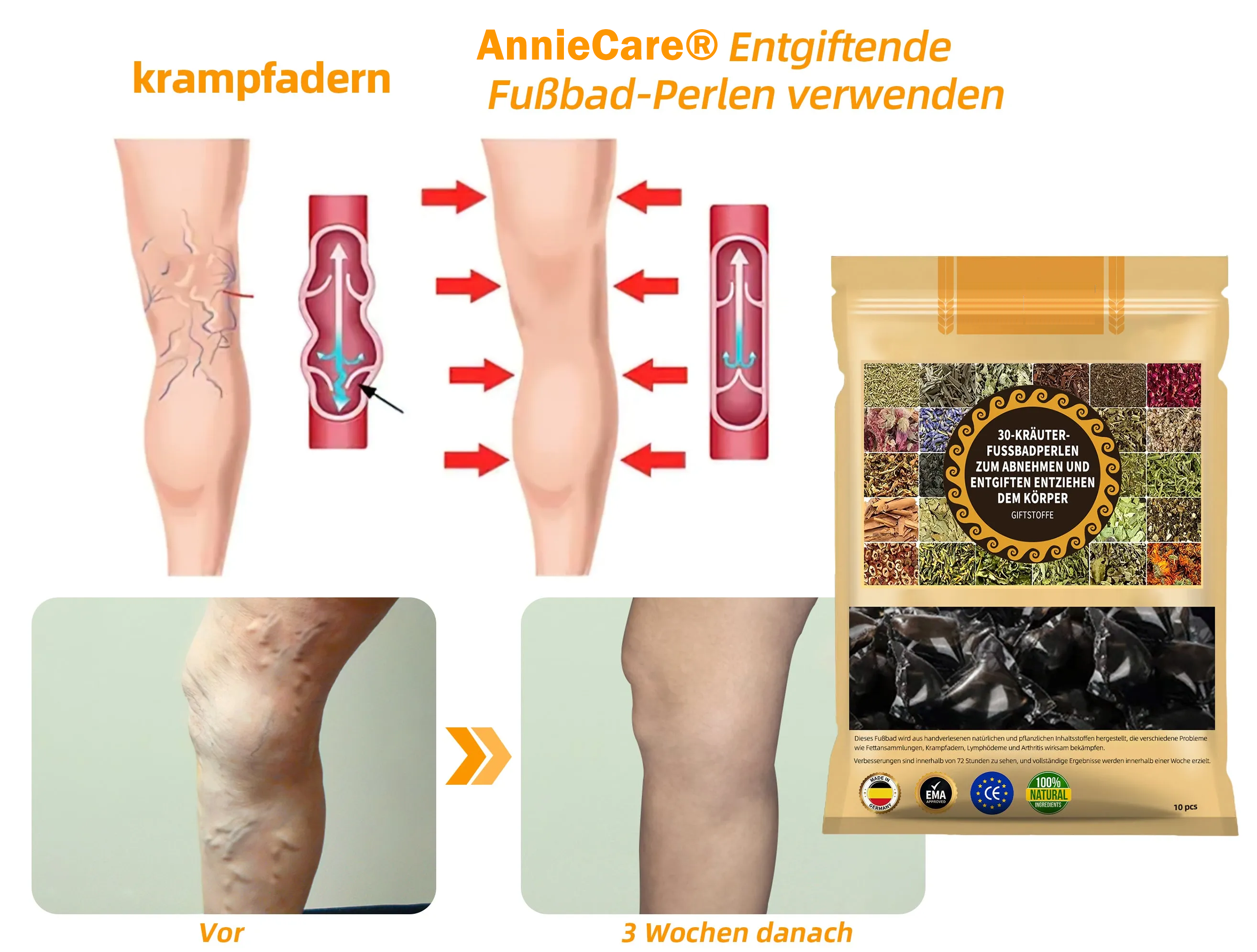 AnnieCare® 𝟯𝟬 𝗞𝗿ä𝘂𝘁𝗲𝗿 𝗟𝘆𝗺𝗽𝗵𝗱𝗿𝗮𝗶𝗻𝗮𝗴𝗲 𝗚𝗲𝘄𝗶𝗰𝗵𝘁𝘀𝘃𝗲𝗿𝗹𝘂𝘀𝘁 𝗙𝘂ß𝗯𝗮𝗱 𝗣𝗲𝗿𝗹𝗲𝗻-💁‍♀️👩‍⚕️𝗘𝗺𝗽𝗳𝗼𝗵𝗹𝗲𝗻 𝘃𝗼𝗻 𝗱𝗲𝗿 𝗗𝗲𝘂𝘁𝘀𝗰𝗵𝗲𝗻 𝗚𝗲𝘀𝗲𝗹𝗹𝘀𝗰𝗵𝗮𝗳𝘁 𝗳ü𝗿 𝗟𝘆𝗺𝗽𝗵𝗼𝗹𝗼𝗴𝗶𝗲 (𝗗𝗚𝗟)