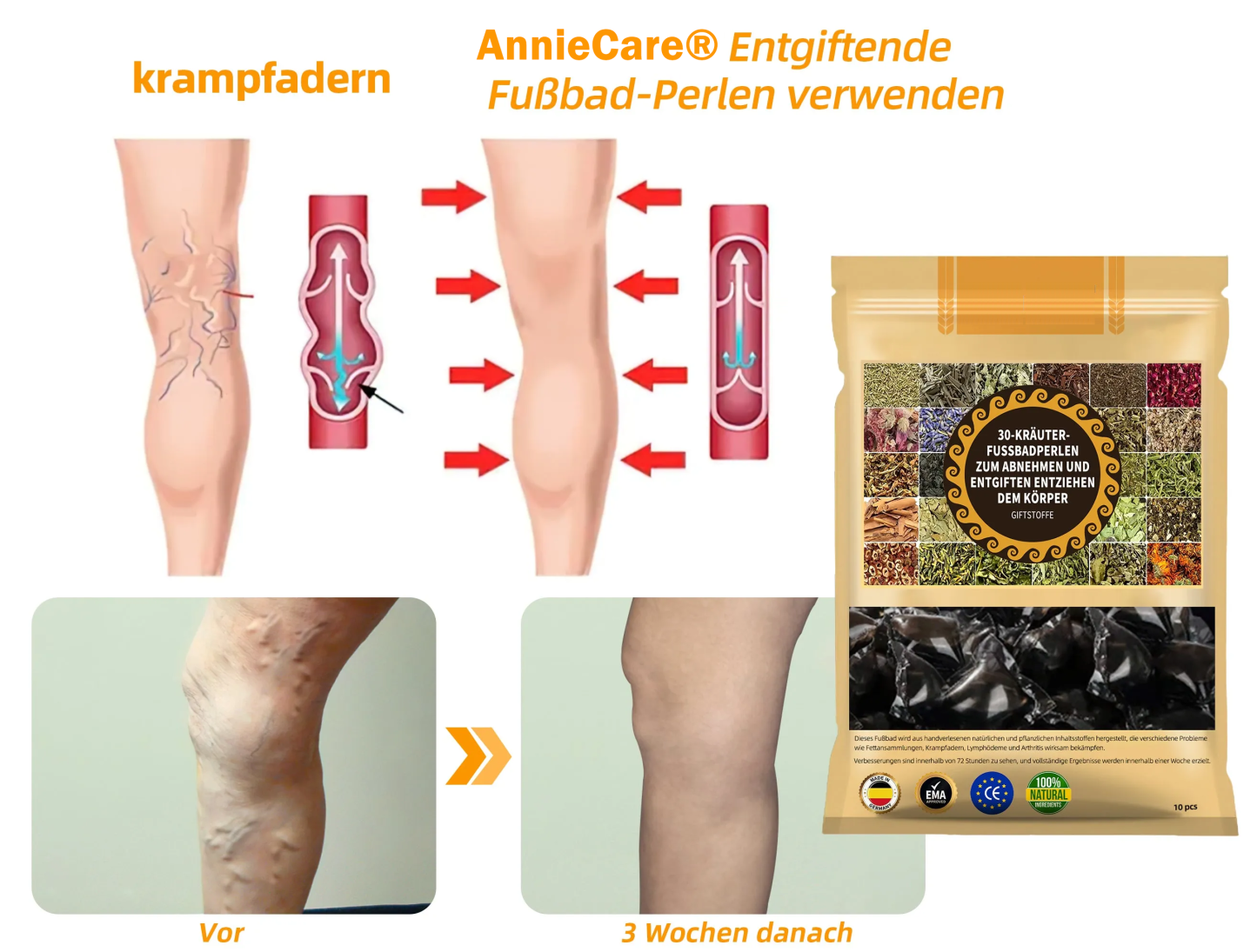 AnnieCare® 𝟯𝟬 𝗞𝗿ä𝘂𝘁𝗲𝗿 𝗟𝘆𝗺𝗽𝗵𝗱𝗿𝗮𝗶𝗻𝗮𝗴𝗲 𝗚𝗲𝘄𝗶𝗰𝗵𝘁𝘀𝘃𝗲𝗿𝗹𝘂𝘀𝘁 𝗙𝘂ß𝗯𝗮𝗱 𝗣𝗲𝗿𝗹𝗲𝗻-💁‍♀️👩‍⚕️𝗘𝗺𝗽𝗳𝗼𝗵𝗹𝗲𝗻 𝘃𝗼𝗻 𝗱𝗲𝗿 𝗗𝗲𝘂𝘁𝘀𝗰𝗵𝗲𝗻 𝗚𝗲𝘀𝗲𝗹𝗹𝘀𝗰𝗵𝗮𝗳𝘁 𝗳ü𝗿 𝗟𝘆𝗺𝗽𝗵𝗼𝗹𝗼𝗴𝗶𝗲 (𝗗𝗚𝗟)