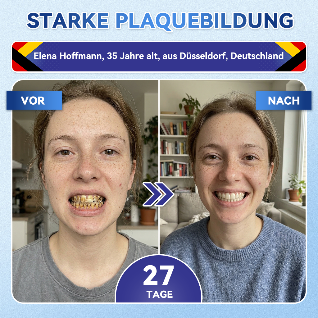 𝐺𝑙𝑖𝑚𝑚𝑒𝑟𝑙𝑦®🌳 Tideglusib Zahn & Zahnfleisch Schnelllösliche Repair-Mundstreifen