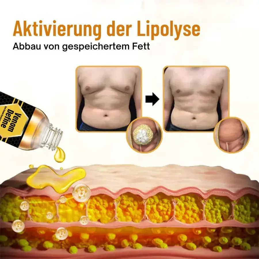 【𝐎𝐟𝐟𝐢𝐳𝐢𝐞𝐥𝐥𝐞𝐫 𝐅𝐥𝐚𝐠𝐬𝐡𝐢𝐩-𝐒𝐭𝐨𝐫𝐞】⏰Letzter Tag der Aktion: 60 % RABATT -  AnnieCare® VenomDefine Bienen­gift-Gynäkomastie-Öl