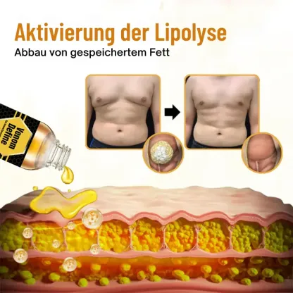 【𝐎𝐟𝐟𝐢𝐳𝐢𝐞𝐥𝐥𝐞𝐫 𝐅𝐥𝐚𝐠𝐬𝐡𝐢𝐩-𝐒𝐭𝐨𝐫𝐞】⏰Letzter Tag der Aktion: 60 % RABATT -  AnnieCare® VenomDefine Bienen­gift-Gynäkomastie-Öl