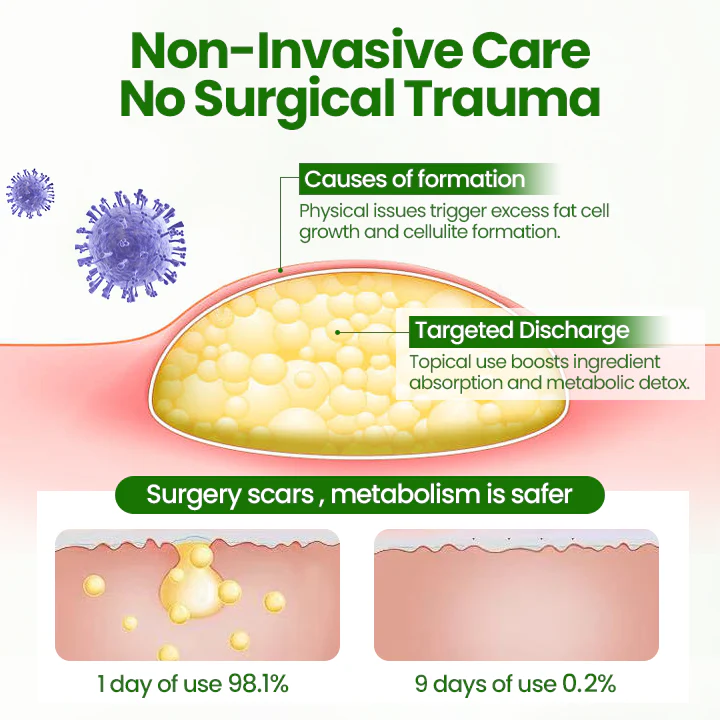 ⏰Last Day Promotion: 60% OFF🔥 Cvreoz® KnotAway Lipoma Removal Cream