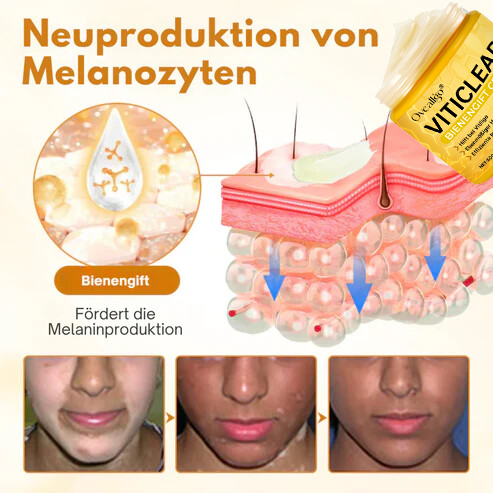 Oveallgo® VitiClear Ultra Bienengift Creme