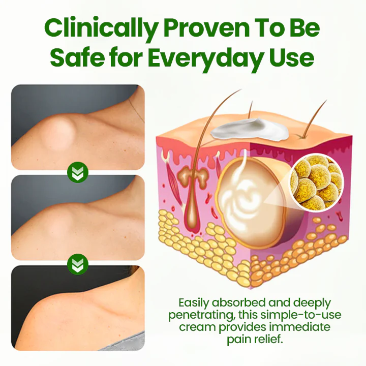 ⏰Last Day Promotion: 60% OFF🔥 Cvreoz® KnotAway Lipoma Removal Cream