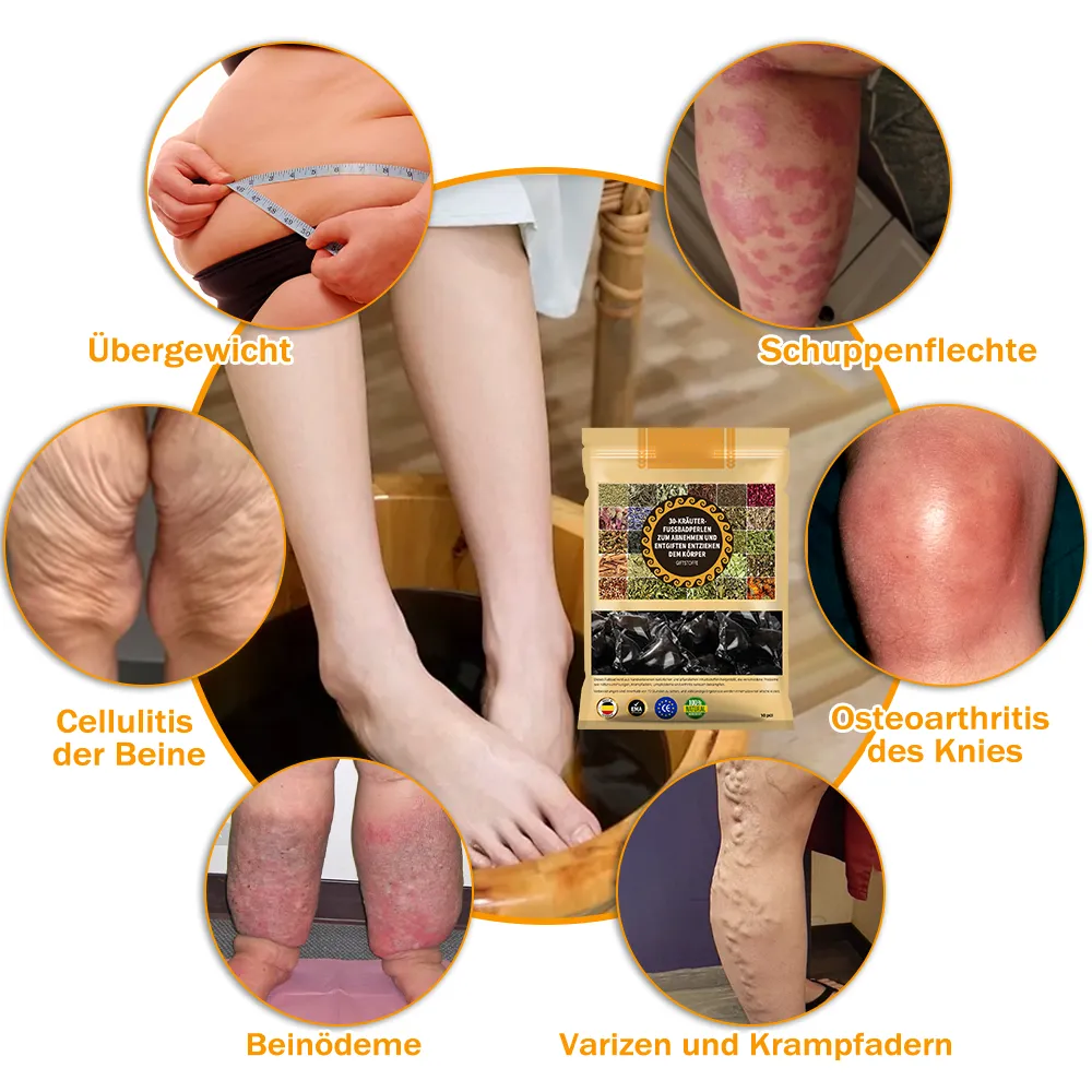 AnnieCare® 𝟯𝟬 𝗞𝗿ä𝘂𝘁𝗲𝗿 𝗟𝘆𝗺𝗽𝗵𝗱𝗿𝗮𝗶𝗻𝗮𝗴𝗲 𝗚𝗲𝘄𝗶𝗰𝗵𝘁𝘀𝘃𝗲𝗿𝗹𝘂𝘀𝘁 𝗙𝘂ß𝗯𝗮𝗱 𝗣𝗲𝗿𝗹𝗲𝗻-💁‍♀️👩‍⚕️𝗘𝗺𝗽𝗳𝗼𝗵𝗹𝗲𝗻 𝘃𝗼𝗻 𝗱𝗲𝗿 𝗗𝗲𝘂𝘁𝘀𝗰𝗵𝗲𝗻 𝗚𝗲𝘀𝗲𝗹𝗹𝘀𝗰𝗵𝗮𝗳𝘁 𝗳ü𝗿 𝗟𝘆𝗺𝗽𝗵𝗼𝗹𝗼𝗴𝗶𝗲 (𝗗𝗚𝗟)