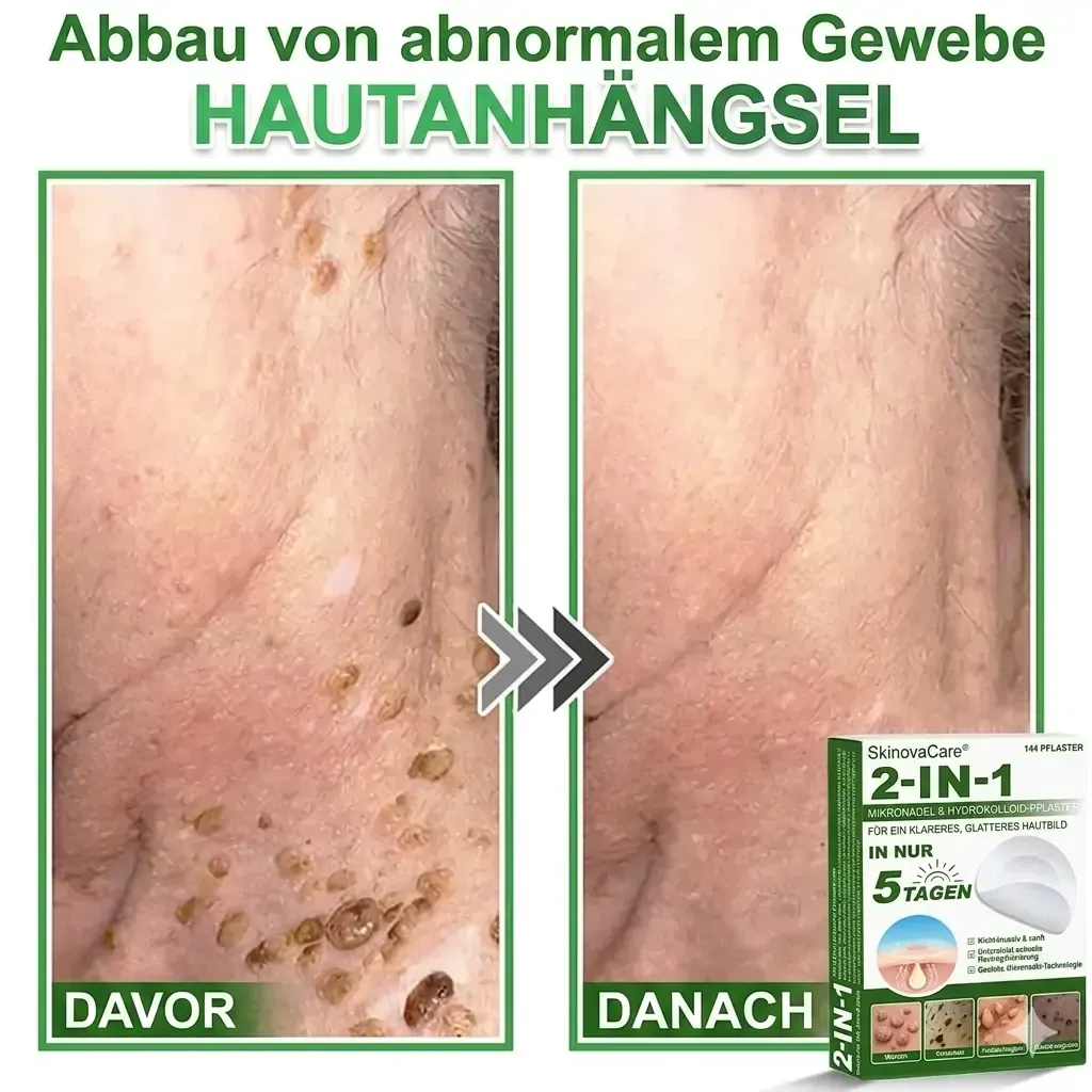 【𝐎𝐟𝐟𝐢𝐳𝐢𝐞𝐥𝐥𝐞𝐫 𝐅𝐥𝐚𝐠𝐬𝐡𝐢𝐩-𝐒𝐭𝐨𝐫𝐞】⏰Letzter Tag der Aktion: 60 % RABATT