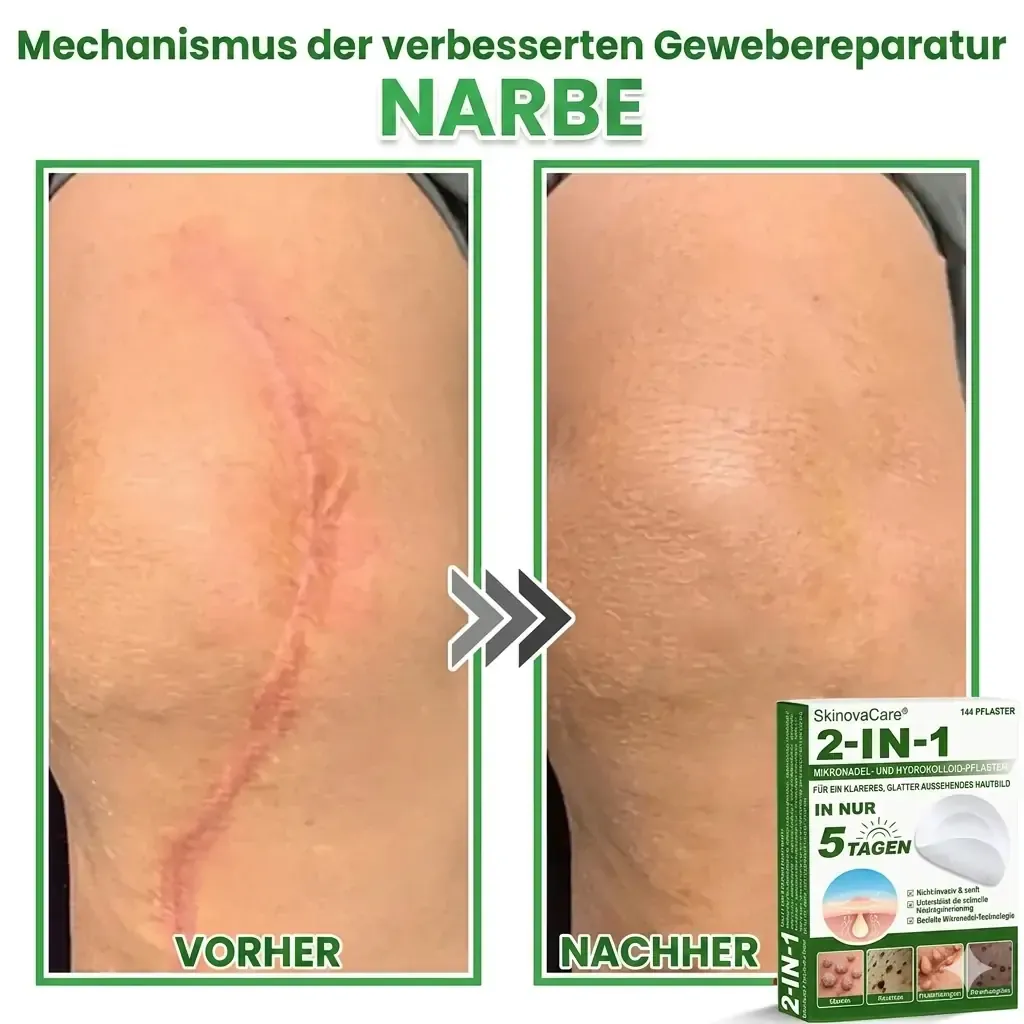 【𝐎𝐟𝐟𝐢𝐳𝐢𝐞𝐥𝐥𝐞𝐫 𝐅𝐥𝐚𝐠𝐬𝐡𝐢𝐩-𝐒𝐭𝐨𝐫𝐞】⏰Letzter Tag der Aktion: 60 % RABATT