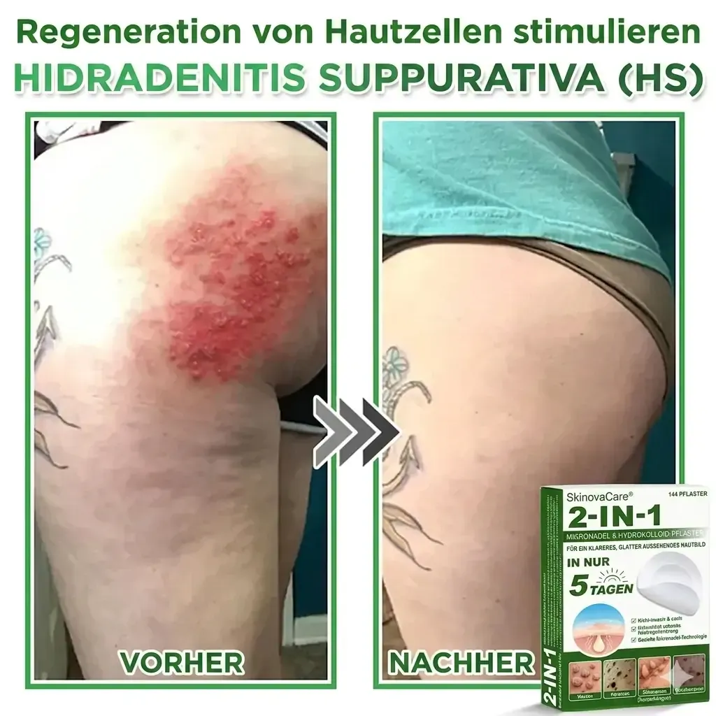 【𝐎𝐟𝐟𝐢𝐳𝐢𝐞𝐥𝐥𝐞𝐫 𝐅𝐥𝐚𝐠𝐬𝐡𝐢𝐩-𝐒𝐭𝐨𝐫𝐞】⏰Letzter Tag der Aktion: 60 % RABATT
