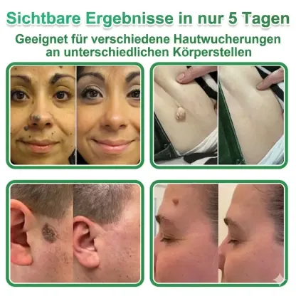 【𝐎𝐟𝐟𝐢𝐳𝐢𝐞𝐥𝐥𝐞𝐫 𝐅𝐥𝐚𝐠𝐬𝐡𝐢𝐩-𝐒𝐭𝐨𝐫𝐞】⏰Letzter Tag der Aktion: 60 % RABATT