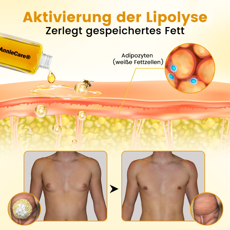 AnnieCare® ThermoFirm Bienengift Öl zur Behandlung von Gynäkomastie